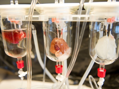 Впервые в истории выращенные в лаборатории клетки сердечной мышцы пересадили человеку