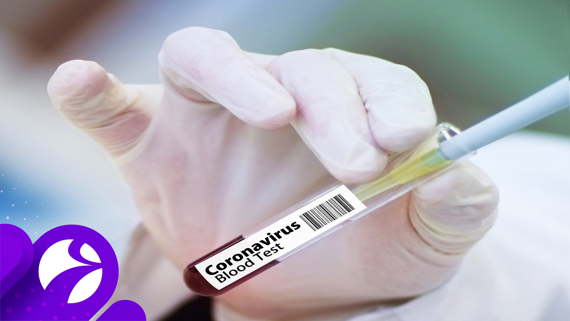 Российскую вакцину от коронавируса планируют зарегистрировать уже через 3 месяца
